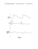 PULSE DETECTION METHOD AND APPARATUS USING PATIENT IMPEDANCE diagram and image