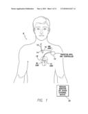 Systems and Methds for Use by an Implantable Medical Device for Controlling Vagus Nerve Stimulation Based on Heart Rate Reduction Curves and Thresholds to Mitigate Heart Failure diagram and image