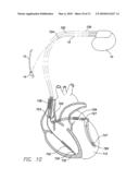 Systems and Methds for Use by an Implantable Medical Device for Controlling Vagus Nerve Stimulation Based on Heart Rate Reduction Curves and Thresholds to Mitigate Heart Failure diagram and image