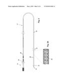 IMPLANTABLE LINE diagram and image