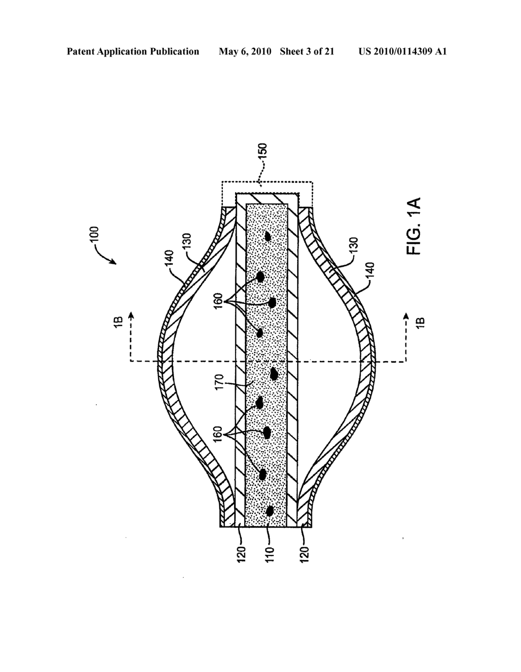 DRUG DELIVERY IMPLANTS FOR INHIBITION OF OPTICAL DEFECTS - diagram, schematic, and image 04