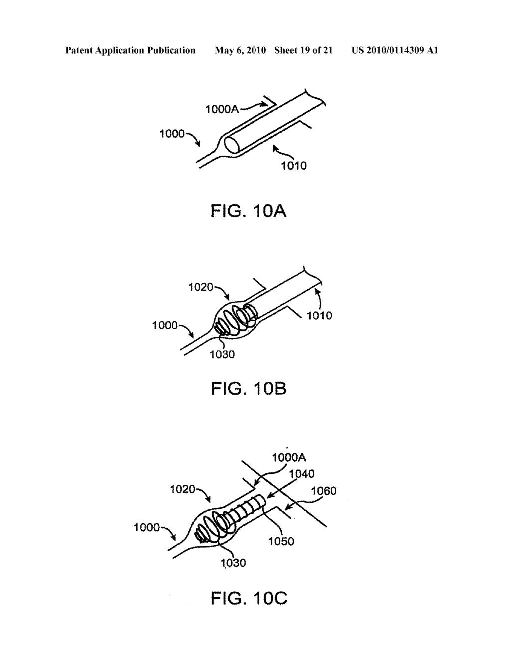 DRUG DELIVERY IMPLANTS FOR INHIBITION OF OPTICAL DEFECTS - diagram, schematic, and image 20