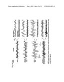 METHOD AND RHYTHM EXTRACTOR FOR DETECTING AND ISOLATING RHYTHMIC SIGNAL FEATURES FROM AN INPUT SIGNAL USING THE WAVELET PACKET TRANSFORM diagram and image