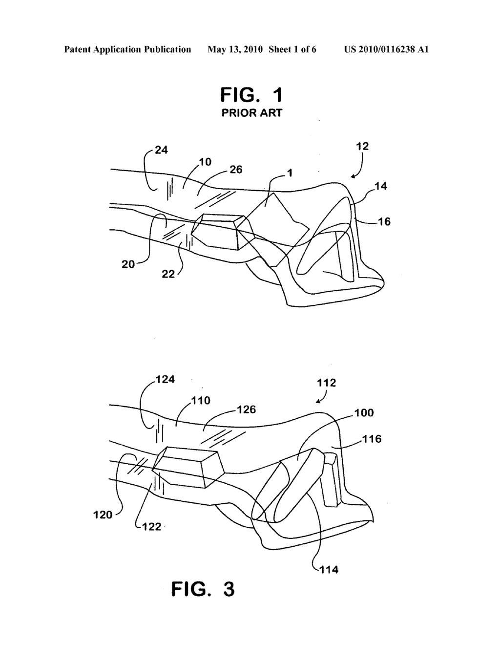 Air Intake Plenum for Air Induction Channel - diagram, schematic, and image 02