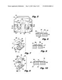 INTERLOCKING BUTTRESS MATERIAL RETENTION SYSTEM diagram and image