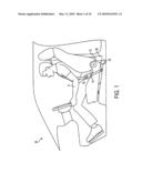 Pretensioned retractor diagram and image