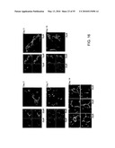 Therapeutic Use of CD31 Expressing Cells diagram and image