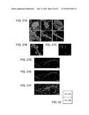 Therapeutic Use of CD31 Expressing Cells diagram and image