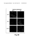 METHODS AND COMPOSITIONS RELATED TO MODULATING THE EXTRACELLULAR STEM CELL ENVIRONMENT diagram and image