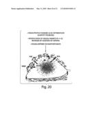 METHODS AND COMPOSITIONS RELATED TO MODULATING THE EXTRACELLULAR STEM CELL ENVIRONMENT diagram and image