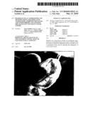 PHARMACEUTICAL COMPOSITIONS AND METHODS USEFUL FOR MODULATING ANGIOGENESIS, INHIBITING METASTASIS AND TUMOR FIBROSIS, AND ASSESSING THE MALIGNANCY OF COLON CANCER TUMORS diagram and image