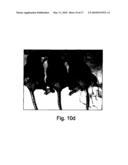 PHARMACEUTICAL COMPOSITIONS AND METHODS USEFUL FOR MODULATING ANGIOGENESIS, INHIBITING METASTASIS AND TUMOR FIBROSIS, AND ASSESSING THE MALIGNANCY OF COLON CANCER TUMORS diagram and image