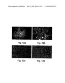 PHARMACEUTICAL COMPOSITIONS AND METHODS USEFUL FOR MODULATING ANGIOGENESIS, INHIBITING METASTASIS AND TUMOR FIBROSIS, AND ASSESSING THE MALIGNANCY OF COLON CANCER TUMORS diagram and image