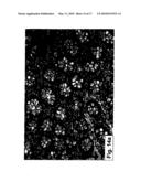 PHARMACEUTICAL COMPOSITIONS AND METHODS USEFUL FOR MODULATING ANGIOGENESIS, INHIBITING METASTASIS AND TUMOR FIBROSIS, AND ASSESSING THE MALIGNANCY OF COLON CANCER TUMORS diagram and image