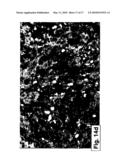 PHARMACEUTICAL COMPOSITIONS AND METHODS USEFUL FOR MODULATING ANGIOGENESIS, INHIBITING METASTASIS AND TUMOR FIBROSIS, AND ASSESSING THE MALIGNANCY OF COLON CANCER TUMORS diagram and image