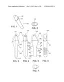 DENTAL IMPLANT diagram and image