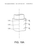 DENTAL IMPLANT diagram and image