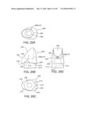 DENTAL IMPLANT diagram and image