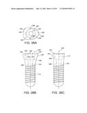 DENTAL IMPLANT diagram and image