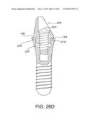 DENTAL IMPLANT diagram and image