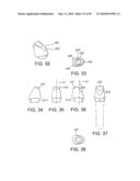 DENTAL IMPLANT diagram and image