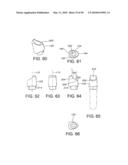 DENTAL IMPLANT diagram and image