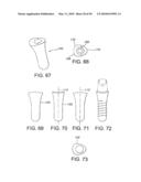 DENTAL IMPLANT diagram and image