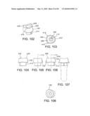 DENTAL IMPLANT diagram and image