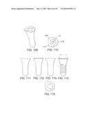 DENTAL IMPLANT diagram and image