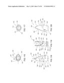 DENTAL IMPLANT diagram and image