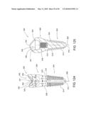 DENTAL IMPLANT diagram and image