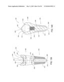 DENTAL IMPLANT diagram and image