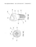 DENTAL IMPLANT diagram and image