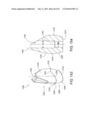 DENTAL IMPLANT diagram and image