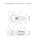 DENTAL IMPLANT diagram and image