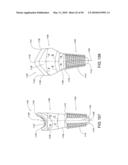 DENTAL IMPLANT diagram and image