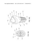 DENTAL IMPLANT diagram and image