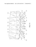 DENTAL IMPLANT diagram and image