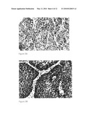 Detection, screening, and diagnosis of HPV-associated cancers diagram and image