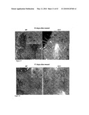 METHODS, KITS, AND COMPOSITIONS FOR GENERATING NEW HAIR FOLLICLES AND GROWING HAIR diagram and image