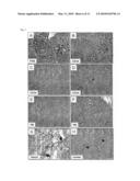 COMPOSITIONS AND METHODS FOR TREATMENT AND PREVENTION OF HYPERURICEMIA RELATED HEALTH CONSEQUNECES diagram and image