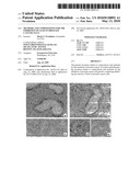 METHODS AND COMPOSITIONS FOR THE INHIBITION OF STAT5 IN PROSTATE CANCER CELLS diagram and image