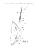 APPARATUS FOR REDUCING PRESSURE IN AN ORGAN diagram and image