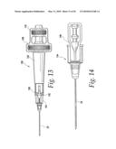 APPARATUS FOR REDUCING PRESSURE IN AN ORGAN diagram and image