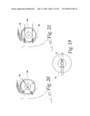 APPARATUS FOR REDUCING PRESSURE IN AN ORGAN diagram and image