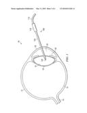 Distal Plastic End Infusion/Aspiration Tip diagram and image