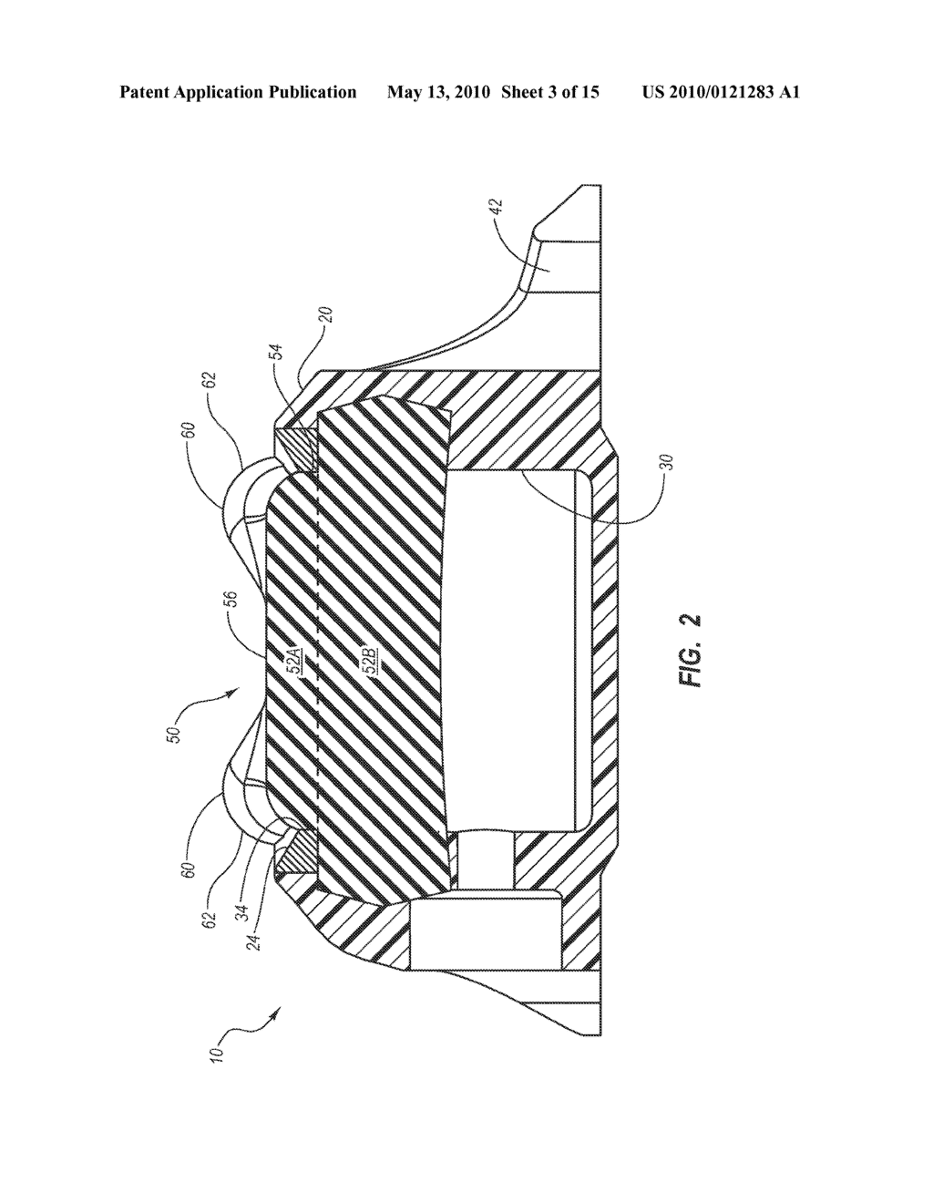 IMPLANTABLE MEDICAL DEVICES INCLUDING SEPTUM-BASED INDICATORS - diagram, schematic, and image 04