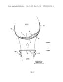 ABSORBENT ARTICLE diagram and image