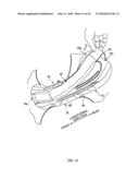 ABSORBENT ARTICLE diagram and image