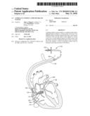 Compliant Guiding Catheter Sheath System diagram and image